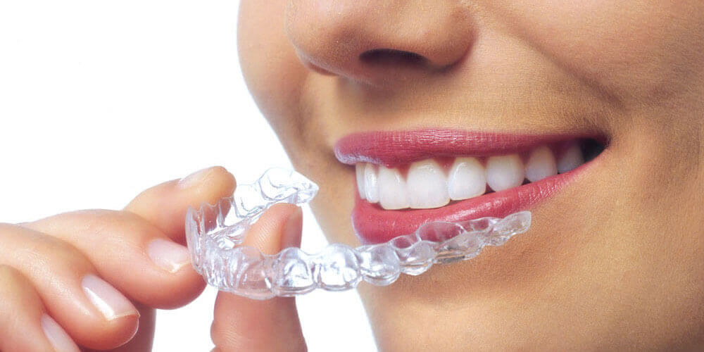 Invisalign Edmonton